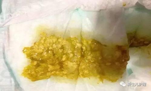 宝宝吃哈密瓜拉肚子吗,哈密瓜致宝宝腹泻？揭秘宝宝食用哈密瓜的注意事项